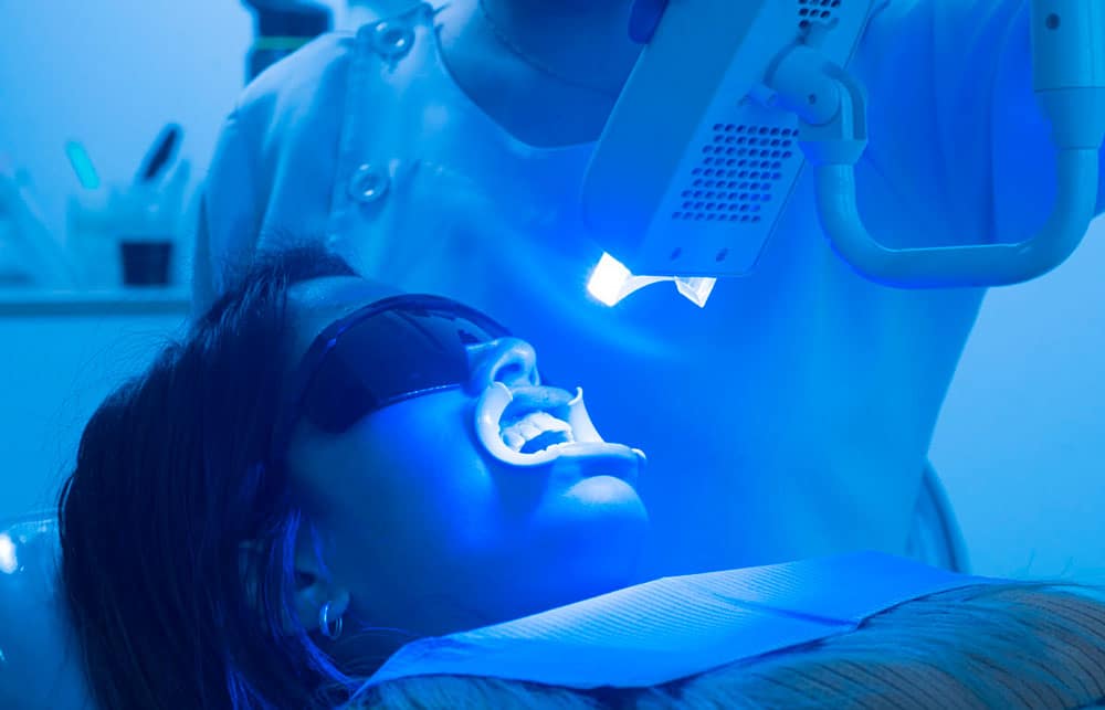 Beneficios de blanqueamiento dental en Antequera