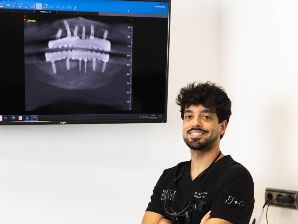 Especialista en implantes dentales en Antequera